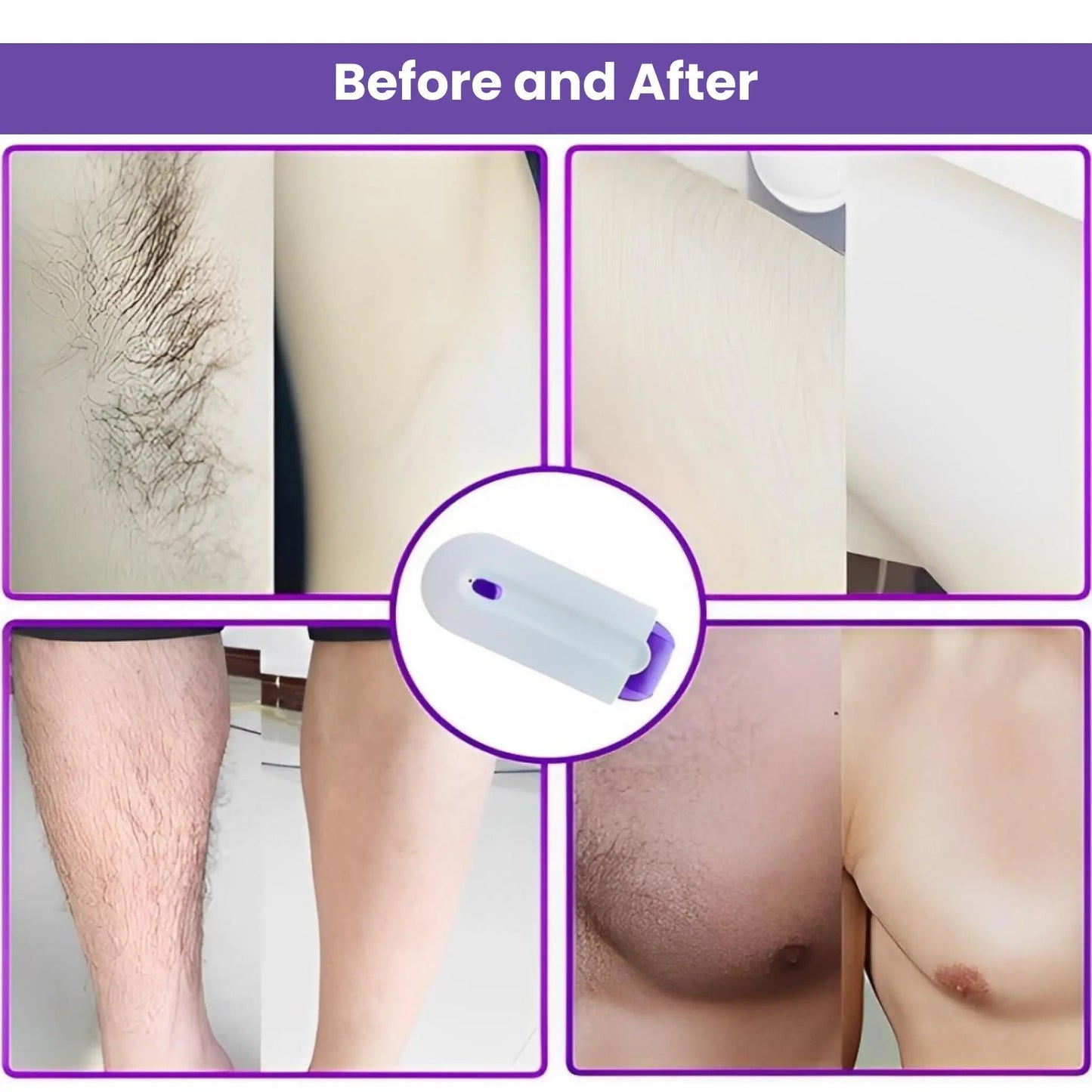 Finishing Touch Yes Hair Remover: Painless & Precise Hair Removal hair removal hair removal 